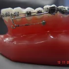 Imagem 2 da empresa LEONIDAS  RENUZZA Dentista - Reabilitação Oral em Curitiba PR