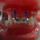 Imagem 1 da empresa LEONIDAS  RENUZZA Dentista - Reabilitação Oral em Curitiba PR
