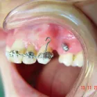 Imagem 3 da empresa LEONIDAS  RENUZZA Dentista - Reabilitação Oral em Curitiba PR
