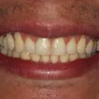 Imagem 1 da empresa ELIODONTO CONSULTÓRIO ODONTOLÓGICO Cirurgiões-Dentistas - Ortodontia e Ortopedia Facial em Rio Branco AC