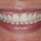 Imagem 3 da empresa ELIODONTO CONSULTÓRIO ODONTOLÓGICO Cirurgiões-Dentistas - Ortodontia e Ortopedia Facial em Rio Branco AC