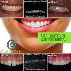 Imagem 2 da empresa ELIODONTO CONSULTÓRIO ODONTOLÓGICO Cirurgiões-Dentistas - Ortodontia e Ortopedia Facial em Rio Branco AC