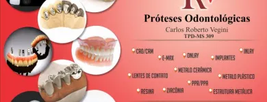 Imagem 1 da empresa CRV LABORATÓRIO DE PRÓTESES ODONTOLÓGICAS Protéticos e Próteses - Artigos e Equipamentos em Campo Grande MS